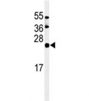 Western blot analysis of ISG15 antibody and HL-60 lysate. Expected molecular weight: 15-17 kDa.