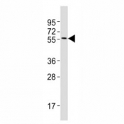 Western blot testing of MITF antibody at 1:2000 dilution + A375 lysate; Predicted molecular weight: 55-60 kDa.