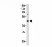 ADA antibody western blot analysis in HL-60 lysate. Expected molecular weight ~41 kDa.