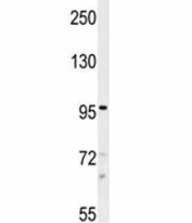 TRPM8 antibody western blot analysis in NCI-H460 lysate. Predicted molecular weight ~128 kDa.