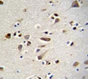 OTX2 antibody immunohistochemistry analysis in formalin fixed and paraffin embedded human brain tissue.