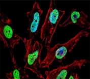Fluorescent confocal image of HeLa cell stained with NKX1.1 antibody. For secondary Ab, Alexa Fluor 488 conjugated donkey anti-rabbit Ab (green) was used (1:400, 50 min at 37oC). NKX1.1 immunoreactivity is localized to the nucleus.