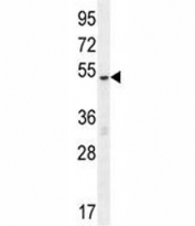 MeCP2 antibody western blot analysis in MDA-MB435 lysate. Observed molecular weight: ~55 kDa and ~75 kDa.