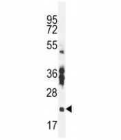 RBPMS2 antibody western blot analysis in mouse stomach tissue lysate.