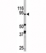 Western blot analysis of LSD1 antibody and mouse brain tissue lysate.