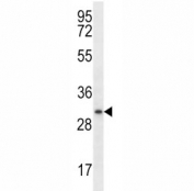 Myogenin antibody western blot analysis in ZR-75-1 lysate. Predicted molecular weight ~25 kDa, routinely observed at ~34 kDa.