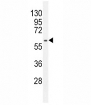 Anti-MDM2 antibody western blot analysis in HepG2 lysate. Predicted molecular weight: ~55 kDa but can be observed at up to ~90 kDa.