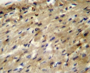 ABCD2 antibody immunohistochemistry analysis in formalin fixed and paraffin embedded human heart tissue.
