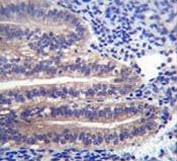 ANGPTL7 antibody immunohistochemistry analysis in formalin fixed and paraffin embedded human uterus tissue.