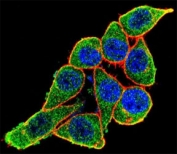 Confocal immunofluorescent analysis of anti-PAX6 antibody with HeLa cells followed by Alexa Fluor 488-conjugated goat anti-rabbit lgG (green). Actin filaments have been labeled with Alexa Fluor 555 Phalloidin (red). DAPI was used as a nuclear counterstain (blue).