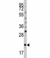 Western blot analysis of Bid antibody and mouse spleen tissue lysate. Predicted molecular weight ~22 kDa.