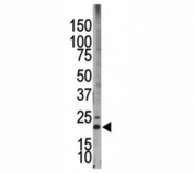 Western blot testing of Bim antibody and HL-60 cell lysate. Predicted molecular weight: 12-22 kDa (three isoforms).