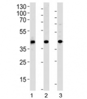 Western blot analysis of 1) human HepG2, 2) mouse kidney and 3) rat spleen tissue lysate using ACADL antibody at 1:1000. Predicted molecular weight ~48 kDa.