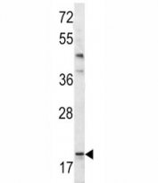 Western blot analysis of Bad antibody and mouse bladder tissue lysate