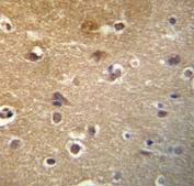 HDAC3 antibody immunohistochemistry analysis in formalin fixed and paraffin embedded human brain tissue.
