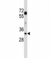 LDHA antibody western blot analysis in MDA-MB231 lysate. Predicted molecular weight ~36kDa.