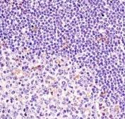 BTK antibody immunohistochemistry analysis in formalin fixed and paraffin embedded human tonsil tissue.