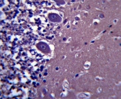 ABHD4 antibody immunohistochemistry analysis in formalin fixed and paraffin embedded human cerebellum tissue.