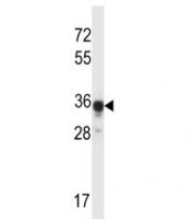 ABHD4 antibody western blot analysis in mouse kidney tissue lysate. Predicted molecular weight ~39 kDa.