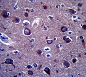 Anti-APP antibody immunohistochemistry analysis in formalin fixed and paraffin embedded human brain tissue.