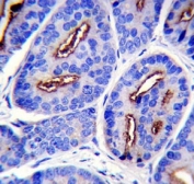 PSMA antibody immunohistochemistry analysis in formalin fixed and paraffin embedded human prostate carcinoma.