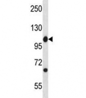 Abl1 antibody western blot analysis in mouse spleen tissue lysate. Predicted molecular weight ~122 kDa.