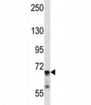 IL1R1 antibody western blot analysis in mouse liver tissue lysate