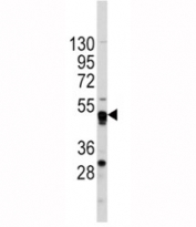 Western blot analysis of GATA4 antibody and CEM lysate. Predicted molecular weight: 42-50 kDa.