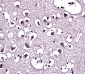LPL antibody immunohistochemistry analysis in formalin fixed and paraffin embedded human brain tissue.