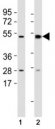 Western blot testing of Mlkl antibody at 1:1000 dilution and mouse samples: (1) lung, (2) spleen lysate; Predicted size: 54 kDa.