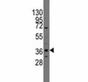 Western blot analysis of PITX2 antibody and CEM lysate. Predicted molecular weight ~35 kDa.
