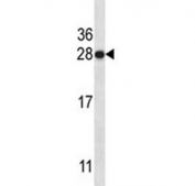 HMGB1 antibody western blot analysis in CEM lysate. Predicted molecular weight ~25 kDa.