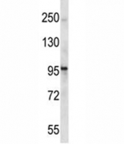 Epha1 antibody western blot analysis in mouse stomach tissue lysate.
