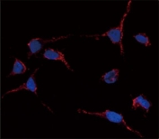 Immunofluorescence analysis of anti-ALDH1A1 antibody and HeLa cells. Primary Ab was followed by Alexa-Fluor-546-conjugated donkey anti-rabbit lgG (H+L). Alexa-Fluor-546 emits orange fluorescence. Blue counterstaining is DAPI.