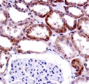CD70 antibody immunohistochemistry analysis in formalin fixed and paraffin embedded human kidney tissue.