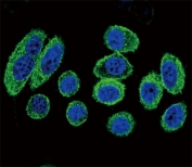 Confocal immunofluorescent analysis of alpha Actin antibody with A549 cells followed by Alexa Fluor 488-conjugated goat anti-rabbit lgG (green). DAPI was used as a nuclear counterstain (blue).