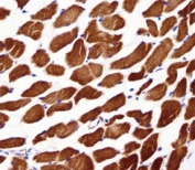 Alpha Actin antibody immunohistochemistry analysis in formalin fixed and paraffin embedded human skeletal muscle