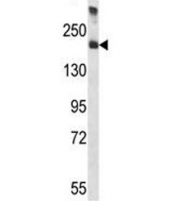 A2M antibody western blot analysis in human placenta tissue lysate. Predicted molecular weight: ~163/200kDa (unmodified/glycosylated).