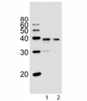 Western blot analysis of lysate from 1) PC3, and 2) LNCaP cell line using VDR antibody at 1:1000. Predicted molecular weight 48/54 kDa (isoforms 1/2).