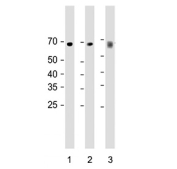 Western blot testing of human 1) HeLa, 2) MDA-MB-231 and 3) A431 cell lysate with CD55 antibody. Observed molecular weight: 41~70 kDa depending on glycosylation level.