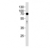 Western blot analysis of lysate from human placenta tissue lysate using anti-Alkaline Phosphatase antibody diluted at 1:1000.