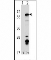 Western blot analysis of Fyn antibody and 293 cell lysate (2 ug/lane) either nontransfected (Lane 1) or transiently transfected (2) with the Fyn gene.