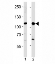 SALL4 antibody western blot analysis in 293,HeLa lysate. Isoform A molecular weight: 112~165 kDa, Isoform B molecular weight: 65~95 kDa.