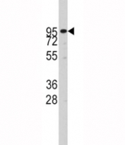 Western blot analysis of ADAM17 antibody and CEM lysate. Expected molecular weight: 80-130KD depending on level of glycosylation