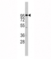 Western blot analysis of ADAM17 antibody and Jurkat lysate. Expected molecular weight: 80-130KD depending on level of glycosylation