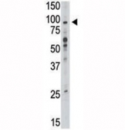 Western blot analysis of TLR6 antibody and mouse liver tissue lysate