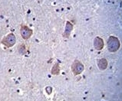 TLR8 antibody immunohistochemistry analysis in formalin fixed and paraffin embedded human brain tissue.