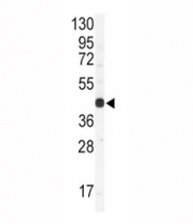 Western blot analysis of Connexin 43 antibody and CEM lysate