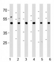 CTBP1 antibody western blot analysis in 1) HeLa, 2) HL-60, 3) Jurkat, 4) Raji cell lines, 5) mouse brain and 6) rat brain tissue lysate. Predicted molecular weight ~48 kDa.