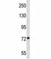 MFN1 antibody western blot analysis in Jurkat lysate.